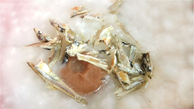 カルシウムたっぷり！『胃に優しい煮干しのおかゆ』レシピ♪